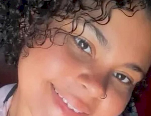 Mulher tem 50% do corpo queimado após ataque do companheiro em Irecê
